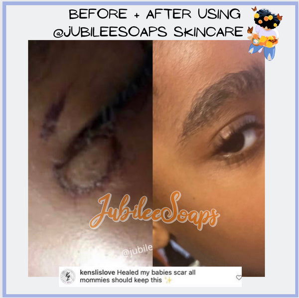 “By my Side” Salve 2 Oz