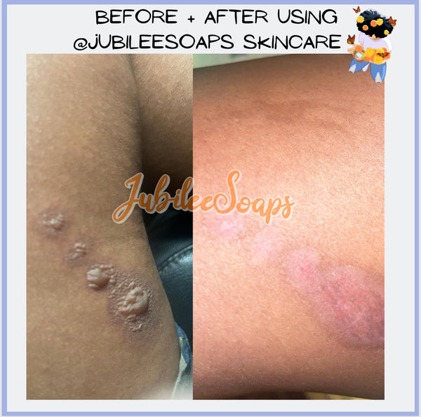 “By my Side” Salve 2 Oz